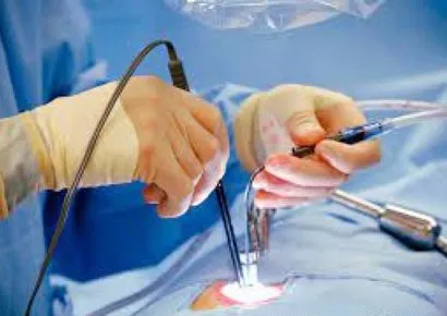 Fellowship in Minimal Access Surgery - General Surgery Course